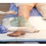 Resistencia antimicrobiana Epidemia pierna herida Ruta Noticias