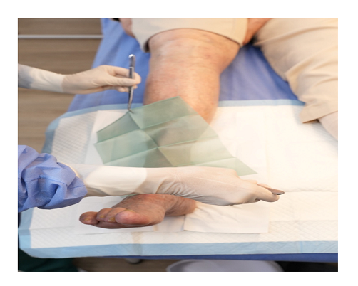 Resistencia antimicrobiana Epidemia pierna herida Ruta Noticias